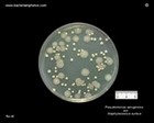Pseudomonas aeruginosa and Staphylococcus aureus on TSA